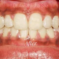 Happy Dentz Dental clinic Medical Services | Dentists